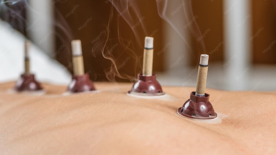 Moxa Moxibustion: Tradition, Anwendung und Wirkungsweise